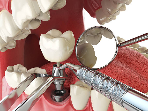 Best Emergency Dental Care for Broken or Chipped Teeth in Mount Hope, WV